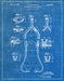 An image of a(n) Stethoscope 1932 - Patent Art Print - Blueprint.